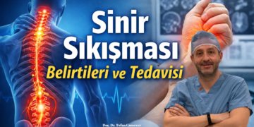 Sinir Sıkışması Nedir? Sinir Sıkışması Belirtileri ve Tedavisi