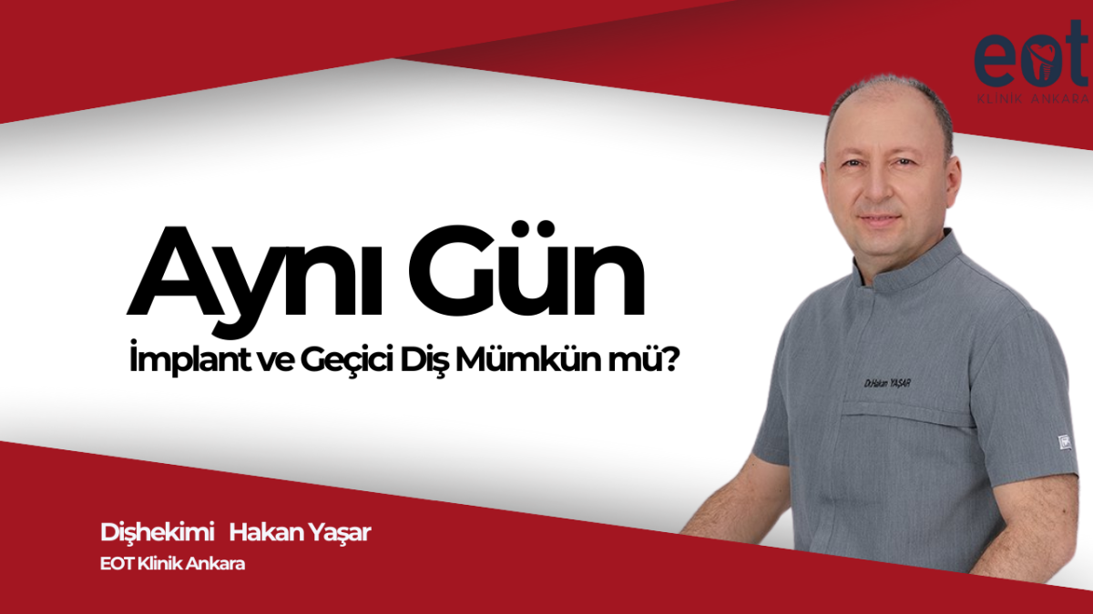 Aynı Gün İmplant ve Geçici Diş Mümkün mü?